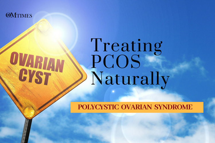Treating PCOS Naturally