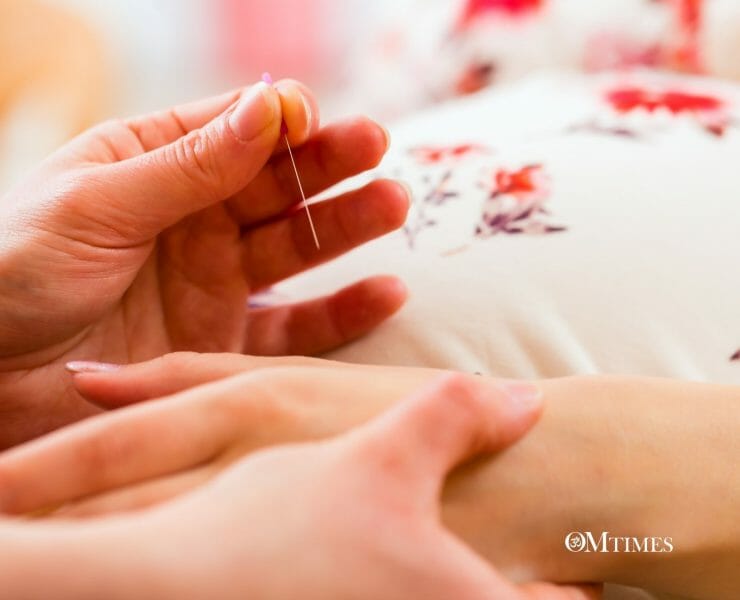 Acupuncture pregnancy OMTimes